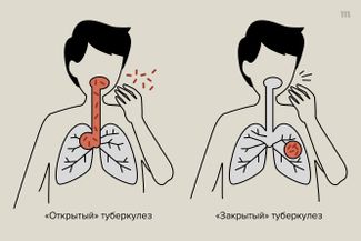 Оригинал иллюстрации — в <a href="https://vaccina.info/brochures/tb" rel="noopener noreferrer" target="_blank">памятке</a> АНО «Коллективный иммунитет»