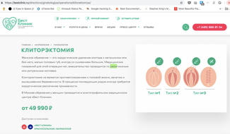 Вот скриншоты других страниц с сайта «Бест Клиник» — в частности, в клинике <a href="https://meduza.bypassnews.online/image/attachments/images/003/653/132/original/m-hKBGHjbNMU97fkmBFB-Q.png" target="_blank">предлагали</a> услугу для девочек до 12 лет, <a href="https://meduza.bypassnews.online/image/attachments/images/003/653/136/original/O7hdkUwSMtVK5PmLtM4-AA.png" target="_blank">описывали</a> особенности операции, <a href="https://meduza.bypassnews.online/image/attachments/images/003/653/140/original/NwK1F4WqrAxoz3hjIHx9UA.png" target="_blank">называли</a> ее «калечащей»